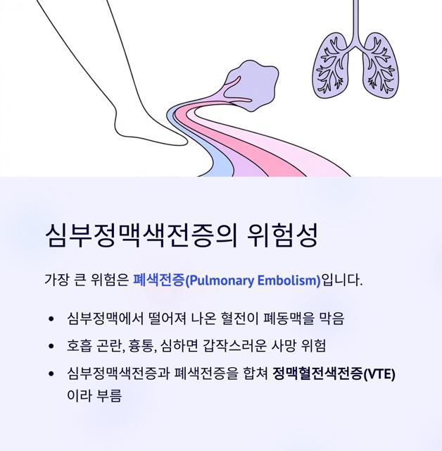 🩺 심부정맥색전증, 혈전이 만들어내는 치명적인 위험