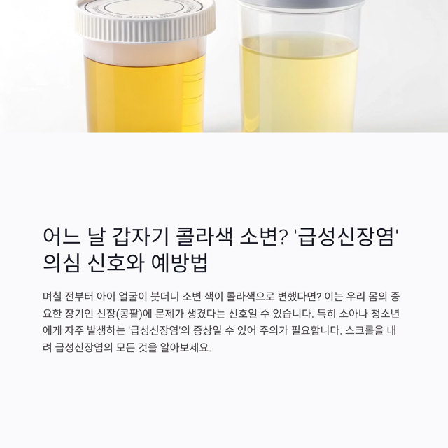 어느 날 갑자기 콜라색 소변? '급성신장염' 의심 신호와 예방법
